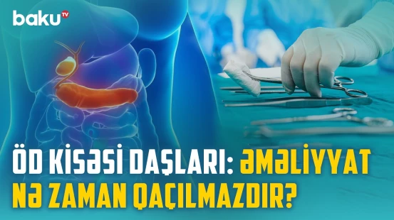 Öd kisəsində daşlar niyə yaranır? - Əsas əlamətlər və səbəblər | BAKU MED