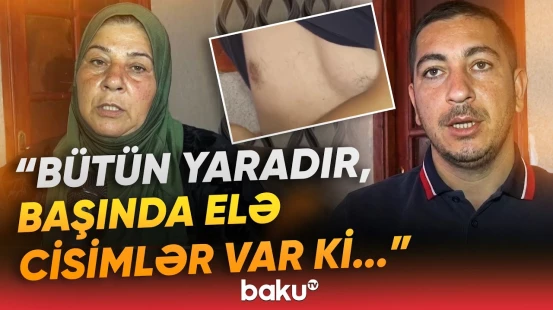 "Balama 50 qəpiklik dondurma ala bilmirəm" - Hərbi xidmətdə yaralanan ata niyə çarəsizdir? - Baku TV