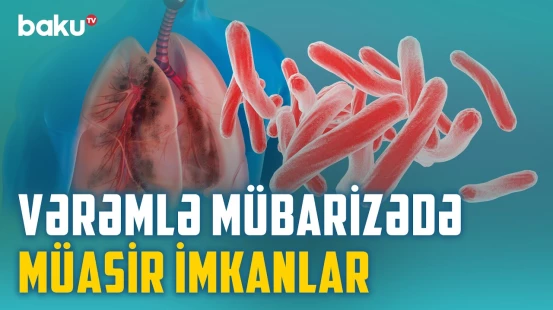 Hansı risk faktorları ağciyər xəstəliklərini artırır? - Müalicəni yarımçıq saxlasanız... - BAKU MED