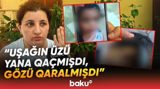 Bağçada dəhşətə gətirən hadisə | "2 aydır həkimlərdəyik, dedilər ki, başına..." - Baku TV