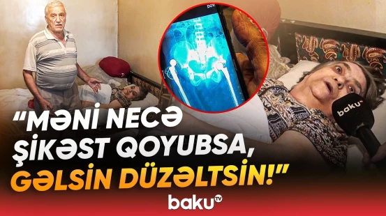 Qadının sol ayağının yerinə sağ ayağı əməliyyat edilib? - "Həkim dedi ki, qayıtmayacağam" - Baku TV