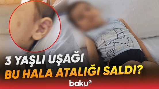 Uşaq xəstəxanalıq oldu, ana isə dedi ki... | Lənkəranda dəhşətə gətirən hadisə - Baku TV