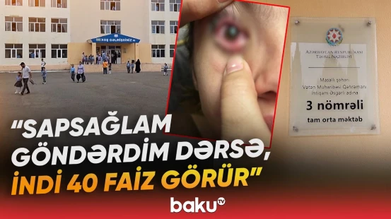 “Sıçrayıb uşağımın üstünə, şərləyirlər ki...” | Məktəbdə qorxunc hadisə: günahkar kimdir? - Baku TV