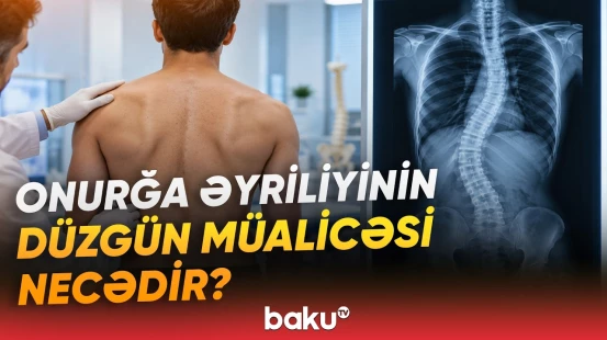 Təhlükə nə zaman artır? - Skoliozun hansı dərəcəsində olanlar hərbi xidmətə yararsızdır? - Baku TV