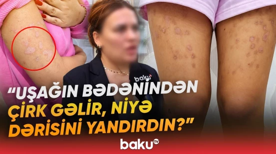 “Uşaq ağlaya-ağlaya çıxıb” | “Mika lazer” salonunda nə baş verib? | “Bədəni bütün yaradır” - Baku TV