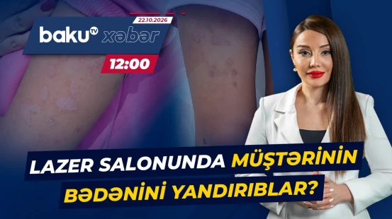 Bakıda yerləşən lazer salonu barədə dəhşətə gətirən ittiham - Baku TV CANLI