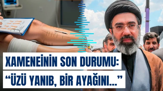 Xameneinin müalicəsinə Pezeşkian da cəlb olunub