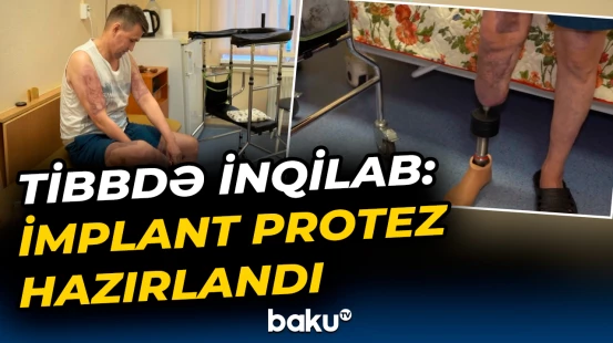 Rusiyada yeni tibbi texnologiya tətbiq olunub