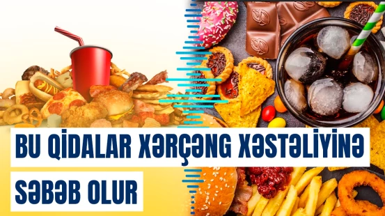 Tez-tez yediyimiz bu 3 qida bağırsaq xərçəngi yaradır