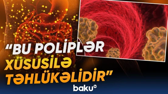 Bağırsaq xərçənginə səbəb olan amillər