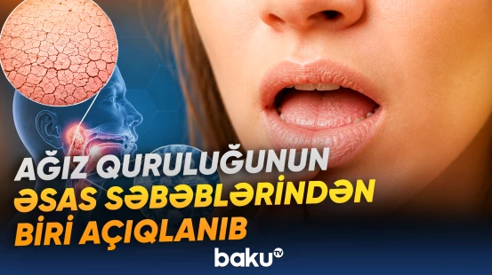 Toxumalardakı ümumi su həcmini müvəqqəti azaldan vasitə