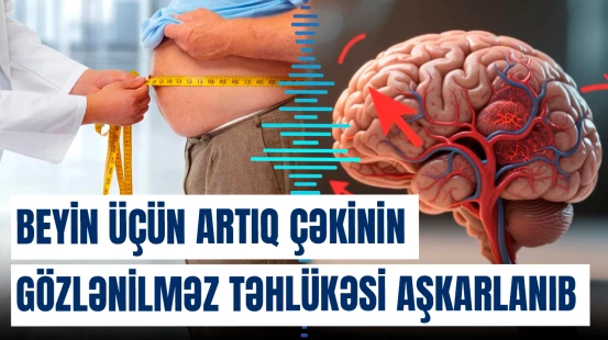 Beyin üçün artıq çəkinin gözlənilməz təhlükəsi aşkarlanıb