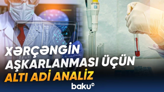 Rusiyalı həkimdən maraqlı açıqlama