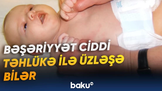 Dünyada doğum səviyyəsi getdikcə azalmağa başlayıb
