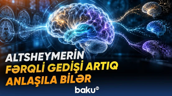 Yeni hesablama modeli Altsheymer xəstəliyinin hər xəstədə fərqli gedişini anlamağa kömək edə bilər