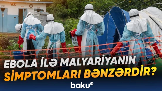 “Xəstəliyin başlanmasından 5-7 gün sonra vəziyyət daha da ağırlaşır” | Xəbərdarlıq
