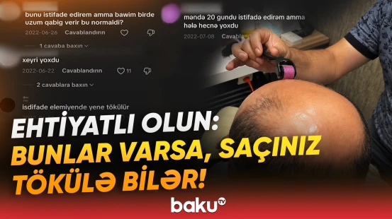 Saç çıxaran vasitələr: nəticə, yoxsa boş vəd? | "İstifadə edirəm, başım, üzüm qabıq verir" - Baku TV
