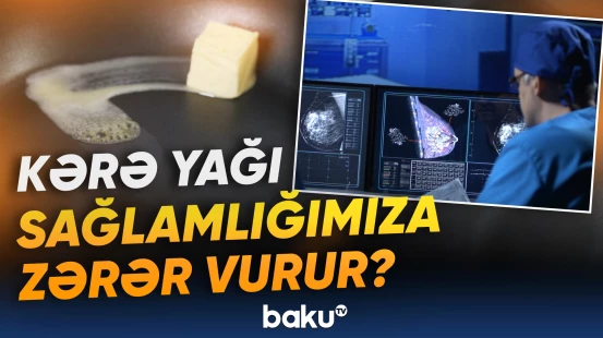 Günlük qida rasionunda əvəzolunmaz yer tutan kərə yağı barədə xəbərdarlıq