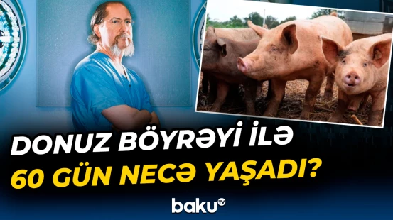 Tibb dünyasını təəccübləndirən hadisə | Donuz böyrəyi ilə yaşayan qadın...