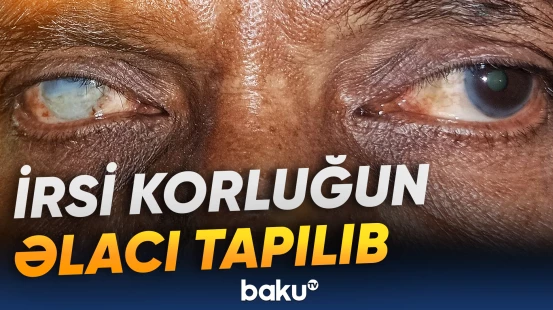 Genetik qüsurun aradan qaldırılması mümkün olacaq