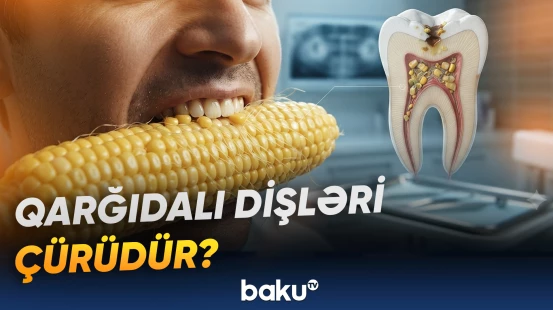Qarğıdalı yeyərkən dişlərdə mikroçatların yaranması riski arta bilər