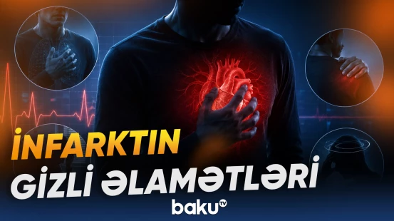 Sinə ağrısından başqa hansı əlamətlər infarkta işarə edə bilər?
