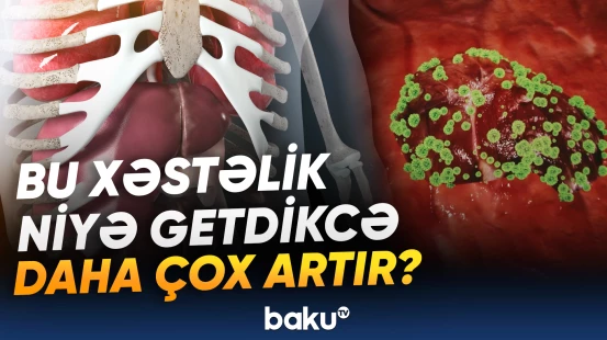 Qaraciyərin piylənməsindən əziyyət çəkənlərin sayı proqnozlaşdırılır
