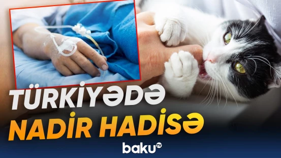 Pişik dişləyən uşaq süni tənəffüs aparatına qoşuldu