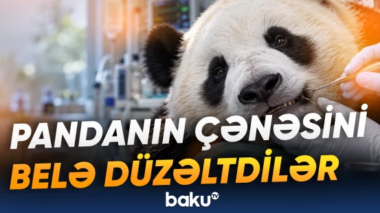 Əyri çənə düzəldildikdən sonra Bəsiyanın qidalanma problemi də aradan qalxıb