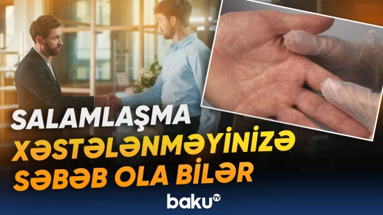 Adi bir salamlaşma hansı xəstəliklərə yol açır?
