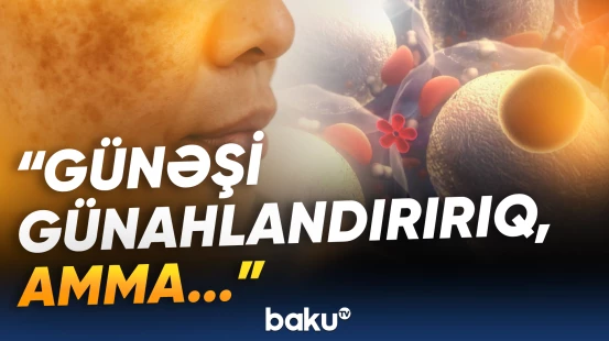 Üzdəki piqment ləkələrinin gözlənilməz səbəbi