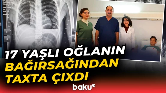 17 yaşlı oğlanın bağırsağından çıxanlara inana bilməyəcəksiniz | Bakı