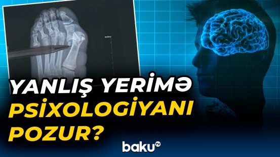 Yanlış yerimə psixologiyanı pozur?