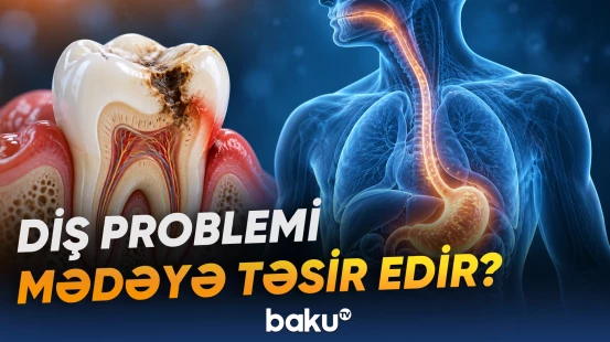Ağız sağlamlığındakı pozuntular orqanizmə müxtəlif təsirlər göstərə bilər