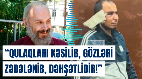 Putinlə bağlı dediklərinə görə axtarılan Mixail Verbitskidən açıqlama