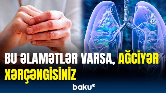 Ağciyər xərçənginin gizli əlamətləri üzə çıxdı | Bu test ilə xəstəliyi aşkarlamaq olarmış