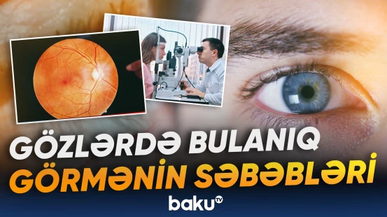 Gözlərdə bulanıq görmənin səbəbləri