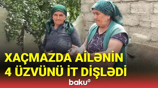 Xaçmazda ailənin 4 üzvünü it dişlədi