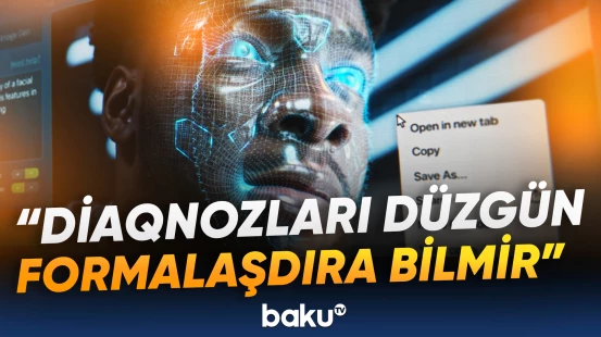 Süni intellekt 80 faiz səhvə yol verir