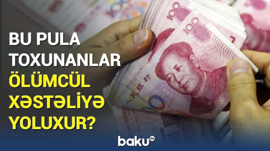 Dünyanın ən çirkli pulları | Toxunandan sonra əllərinizi yumasanız...