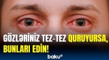 Göz quruluğunun əsas səbəbləri açıqlandı | Həkimlərdən həyəcan təbili