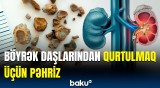 Böyrək daşlarından necə azad olaq? - Gün ərzində 6 qramdan çox...