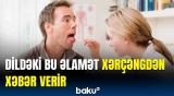 Bu əlamətləri önəmsəmirsinizsə, səhv edirsiniz! - Ağız xərçəngi barədə xəbərdarlıq