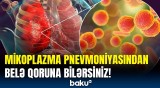 Mikoplazma pnevmoniyasının simptomları açıqlandı | Kimlər yoluxa bilər?