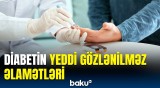 Diabetin əmələ gətirdiyi yaralar gec sağalır? | Endokrinoloqdan maraqlı məlumatlar