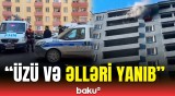 Saraydakı yanğında xəsarət alan şəxsin ən son vəziyyəti açıqlandı