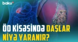 Öd və qaraciyər xəstəlikləri: əməliyyat hansı halda şərtdir? - Xərçəng riski yaradan amil | BAKU MED