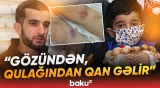 ”Aciz ata kimi xahiş edirəm” | Ağır xəstəlikdən əziyyət çəkən Pünhanın atası imdad dilədi - Baku TV
