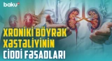 Böyrəkləri nələr məhv edir? - Xroniki böyrək xəstəliyinin hansı əlamətləri var? | BAKU MED