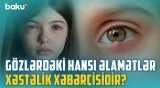 Gözlərin zəifləməsinin başlıca səbəbləri | Görmə qabiliyyətini itirməmək üçün nə etməli? - BAKU MED